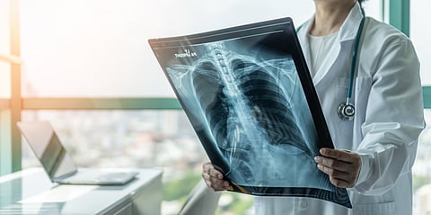 Positive change is happening that has the potential to improve outcomes for lung cancer patients everywhere.