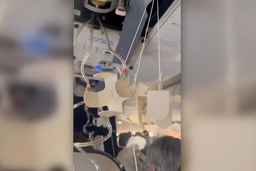 United Express flight diverts to Austin after severe turbulence; 2 passengers hospitalised