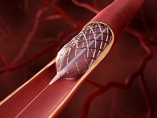 Next-gen care: nanotech to interventional excellence 