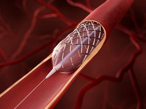 Next-generation cardiac treatments: From nanotech to interventional excellence