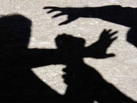 Father and son assault man, causing 10% leg disability; court orders Dh30,000 compensation