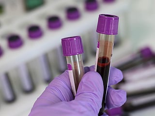 Changing blood types was once thought impossible - scientists just did it