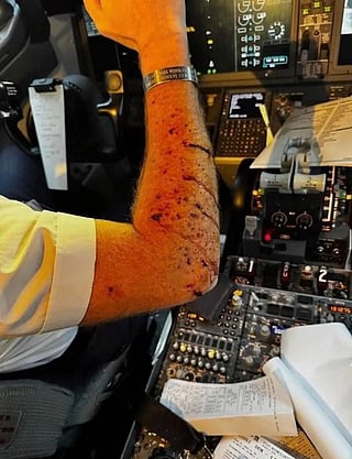 The Boeing 737 Max 8 carrying 140 passengers and crew, was diverted for an emergency landing after the aircraft experienced a cracked cockpit windshield, resulting in bruises for the pilot. 