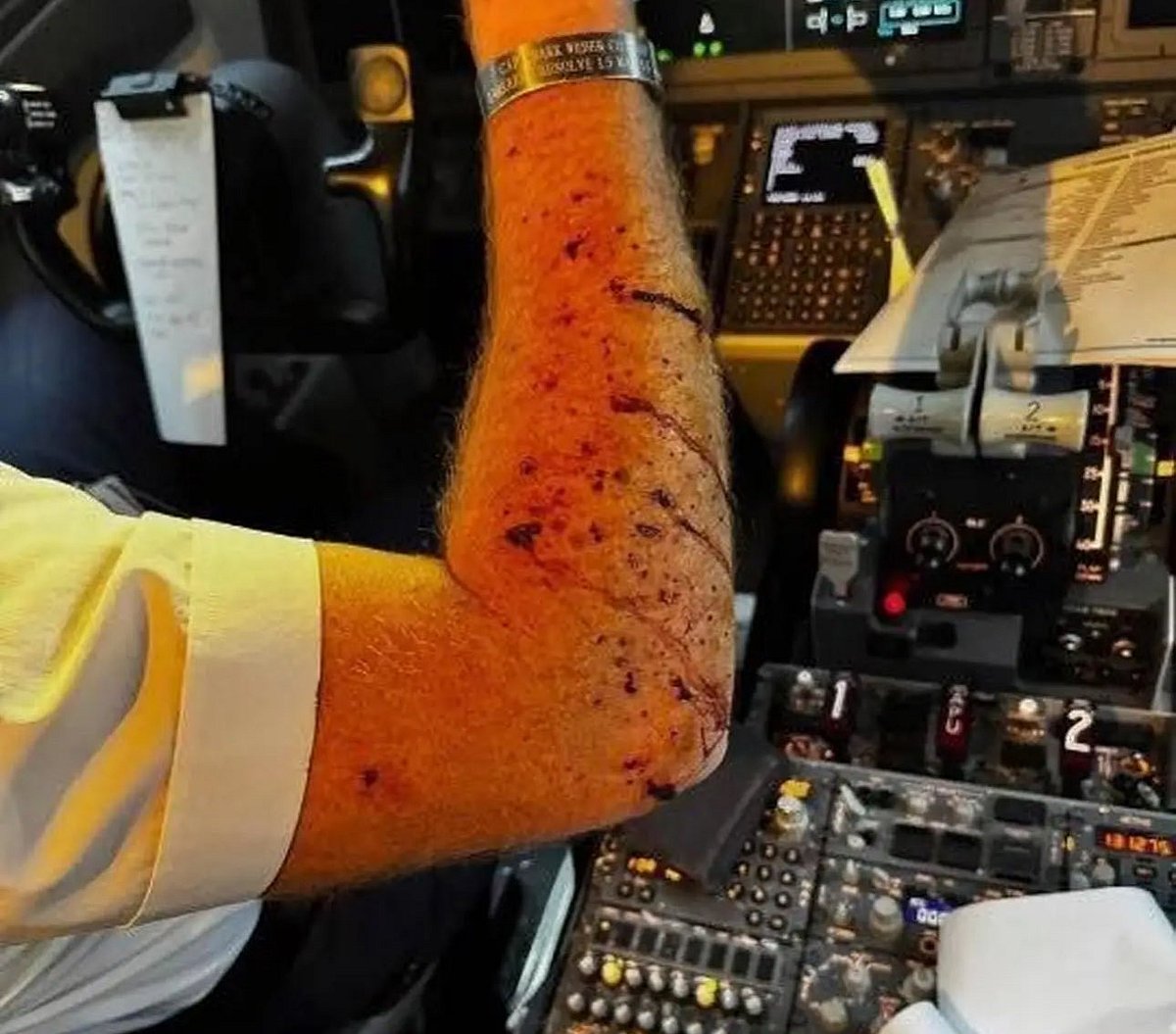 The Boeing 737 Max 8 carrying 140 passengers and crew, was diverted for an emergency landing after the aircraft experienced a cracked cockpit windshield, resulting in bruises for the pilot. 
