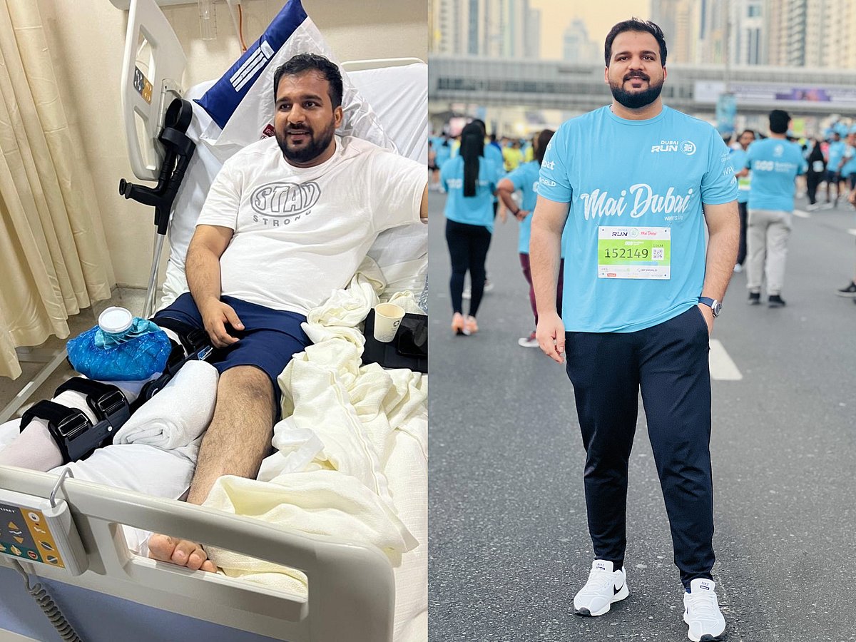 Before and after Nabeel’s remarkable recovery from knee surgery to completing the Dubai Run 5 km.