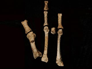 The Burtele foot, which had been a mystery since being discovered in Afar Region in Ethiopia, in 2009, with its elements in the anatomical position.