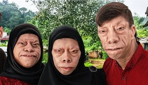 Manurung siblings challenge prejudice with honesty and humour and use social media to spread awareness.