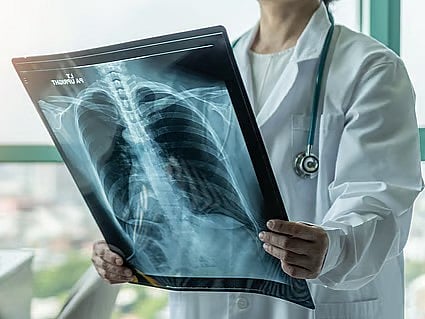 Saudi Arabia become world's first to conditionally approve Anktiva for advanced lung cancer