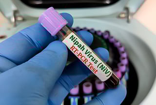 According to India's high ranking health officials mentioned that  both states Kerala and West Bengal are endemic to the virus.  