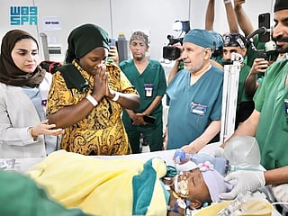 The operation is the third successful separation of conjoined twins from Tanzania and the 71st procedure carried out under the Saudi Conjoined Twins Programme.
