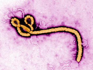 This undated colorized transmission electron micrograph file image made available by the Centers for Disease Control and Prevention (CDC) shows an Ebola virus virion. 