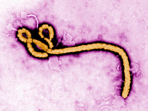 This undated colorized transmission electron micrograph file image made available by the Centers for Disease Control and Prevention (CDC) shows an Ebola virus virion. 