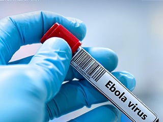 UAE reviews Ebola developments, reinforces health preparedness measures