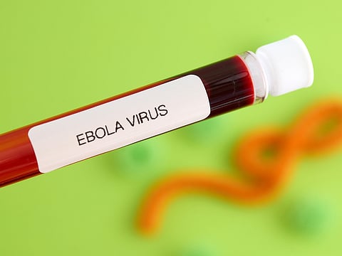 The ministry addressed several common misconceptions about Ebola.
