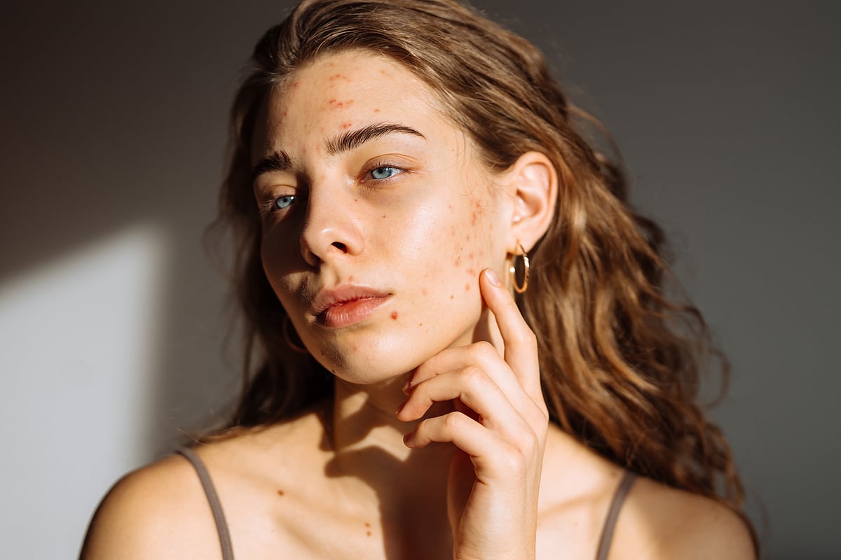 Skincare