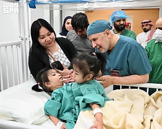 Dr Abdullah Al Rabeeah (right) and Ginalyn Manuel with Olivia and Gianna before the surgery.