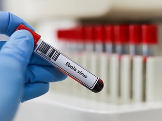 Uganda declares Ebola outbreak over after 42 days