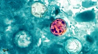 Cyclosporiasis is an intestinal infection that spreads when people ingest food or water contaminated with stool.