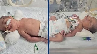 Egyptian doctors deliver twins alive after mother’s cardiac arrest, highlighting lifesaving emergency care and the importance of rapid maternal intervention.