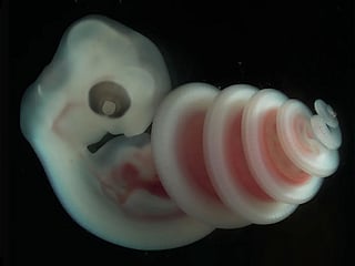 A study of snake embryos reveals how their rapidly growing bodies form a distinctive spiral.