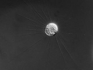 The Scottish microbe grows offspring inside itself — and some are already carrying offspring.