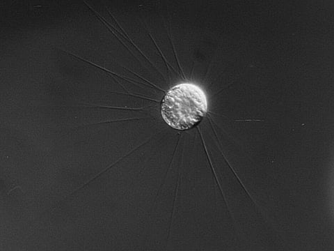 The Scottish microbe grows offspring inside itself — and some are already carrying offspring.