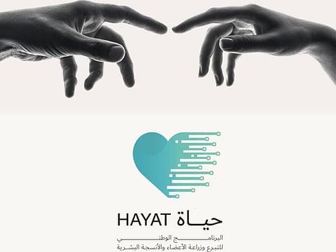 Deceased organ donation increased by 35 per cent between 2024 and 2025, with the number of deceased donors rising from 110 to 149. 