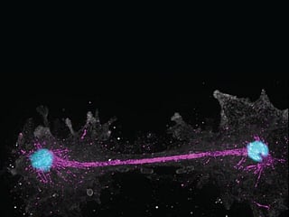 Incendiamoeba cell undergoing mitosis at 63ºC. DNA is colored blue, tubulin is pink, and membrane is gray.

