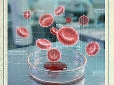 UAE approves new drug for rare blood disorder that raises red blood cells and clot risk