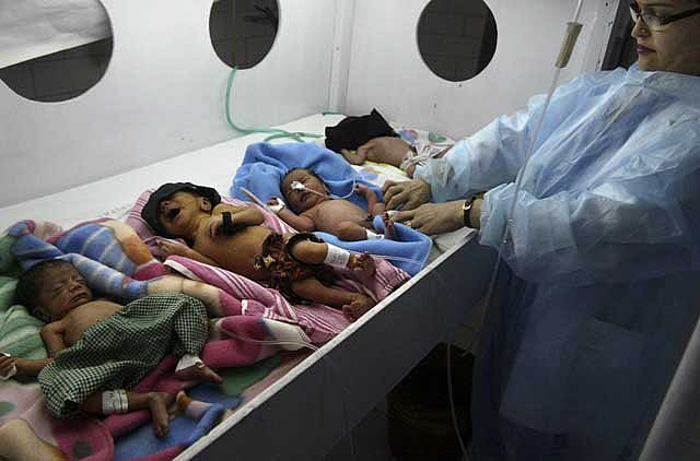 1.1572878-3274056220