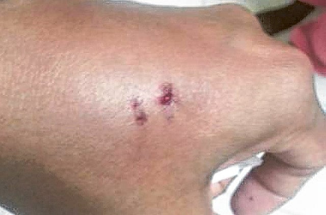 1.1098478-1817910752