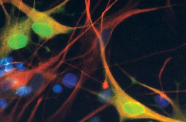 1.2218521-2213407218