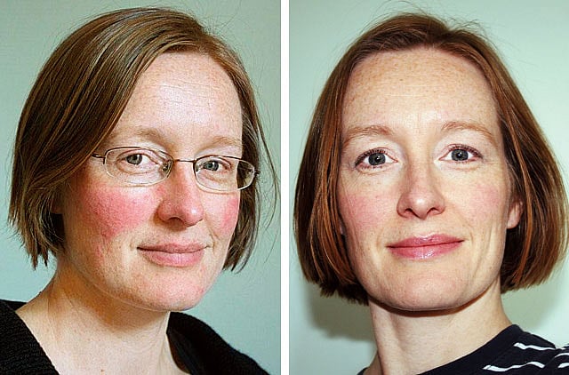 1.1030111-2973986668