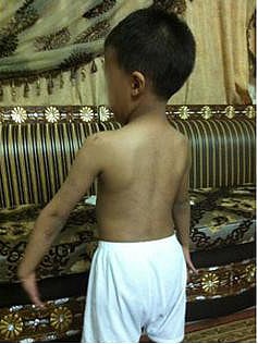 Saudi grandmother in custody battle for abused children