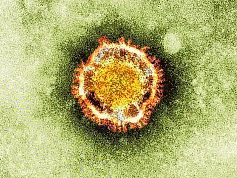 Sars-like virus kills two more in Saudi Arabia