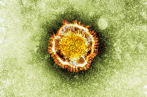 
The coronavirus, seen
under a miscroscope, is
from the same viral family
that triggered Sars.