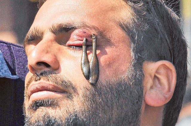 1.1164004-2056659277