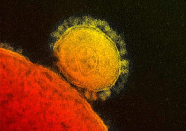 1.1255116-2229294834