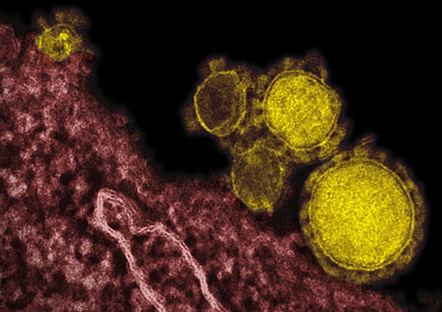 1.1200297-4052283528