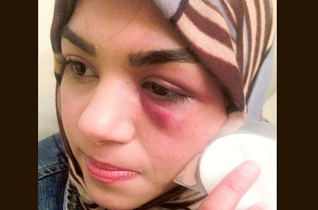 1.1279610-3884071575