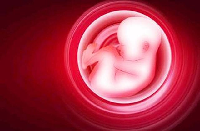 1.1308178-1038565943