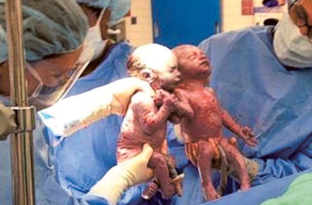 1.1331970-3620442182