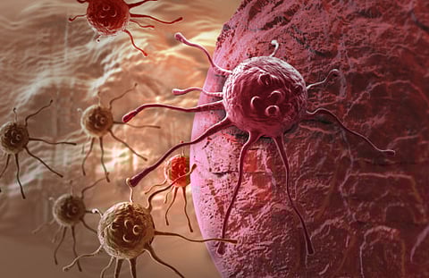 2021: UAE aims to cut cancer cases by 18%