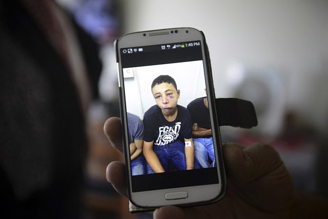 1.1356304-2062887746