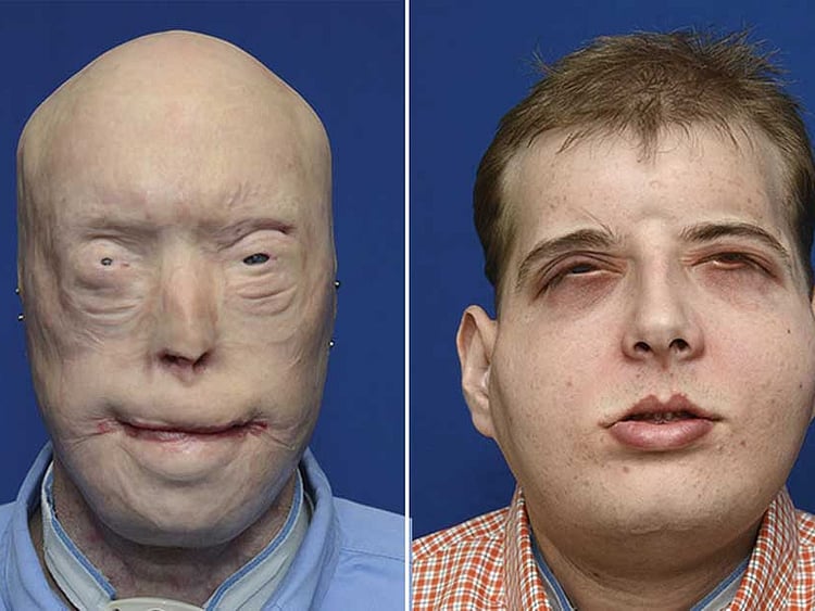 1.1621294-2973986668