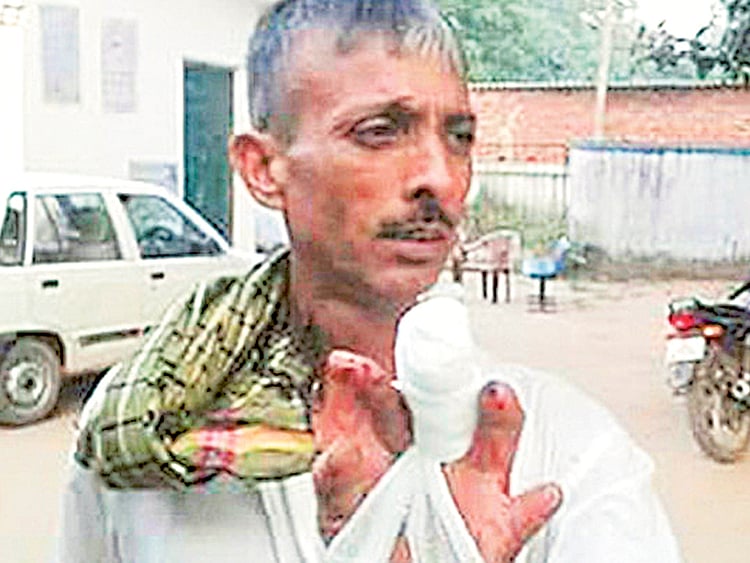 1.1623823-1647570896