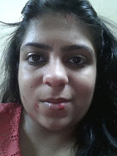 1.1478709-1253274474