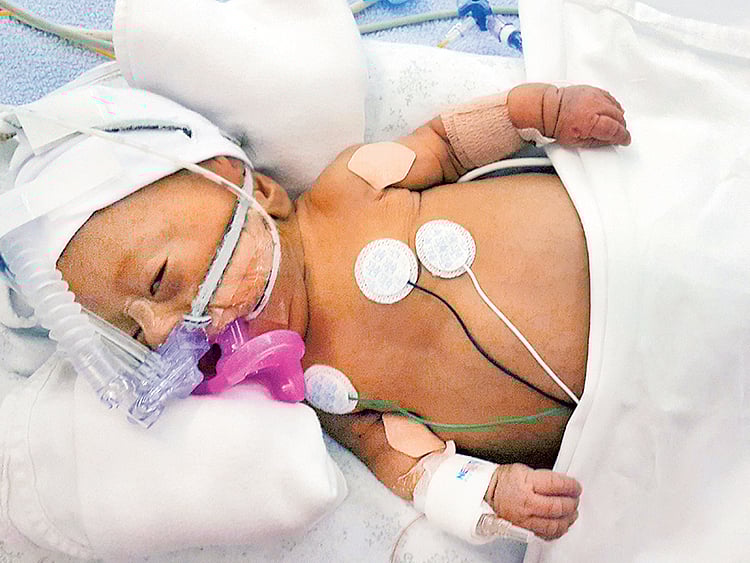 1.1481539-2172471494