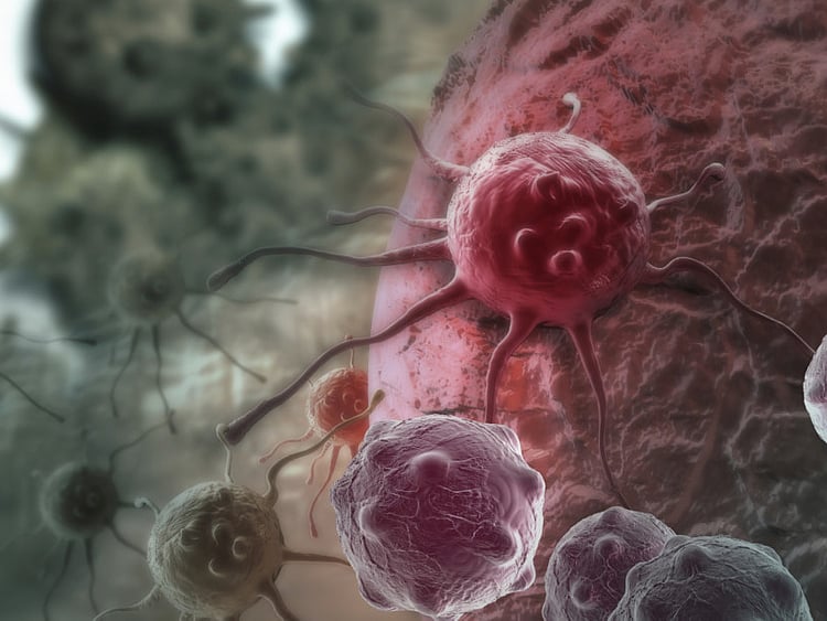 1.1492431-2315236209