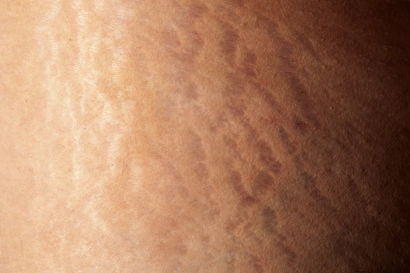 1.1528340-1950010853